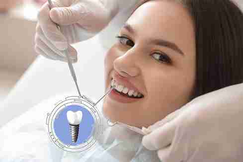 a dental implant